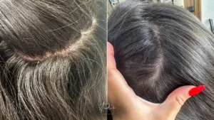 Lire la suite à propos de l’article Pellicules cheveux : causes et solutions adaptées